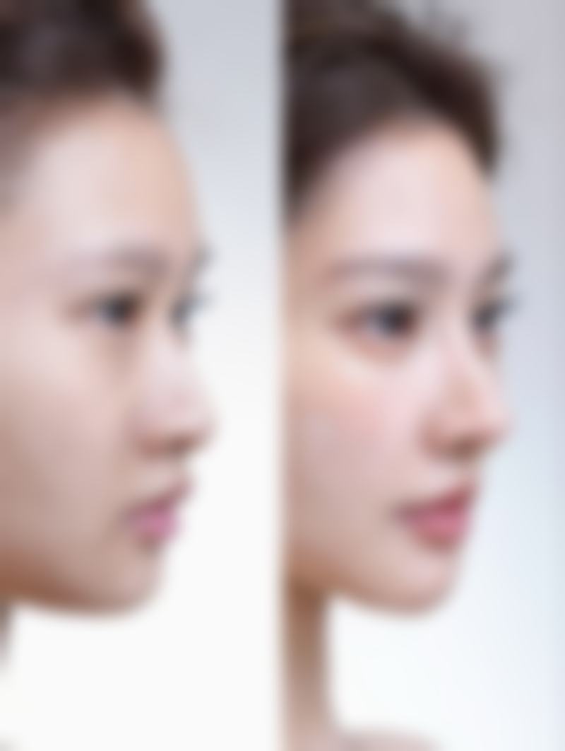 李继先医生看诊优势：贴心服务暖人心