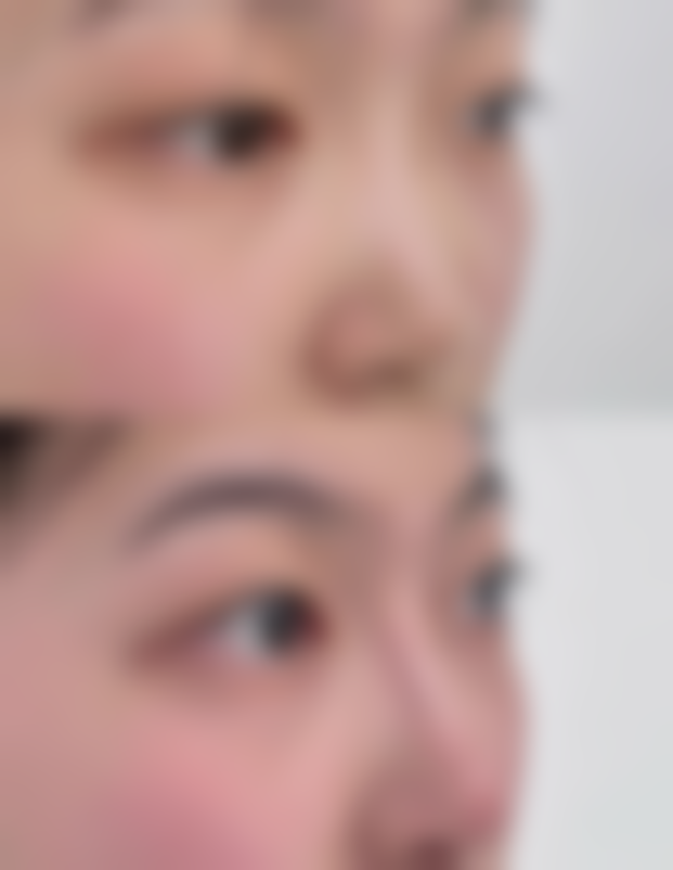 李凤华医生（口腔领域）技术特点