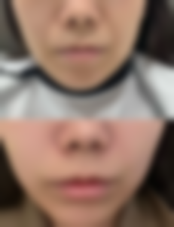 刘克礼医生技术特点