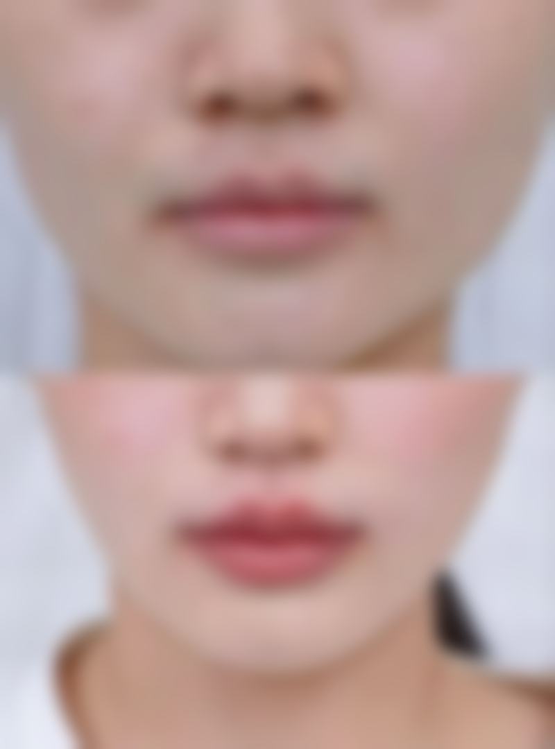 李凤华医生（超声领域）看诊优势