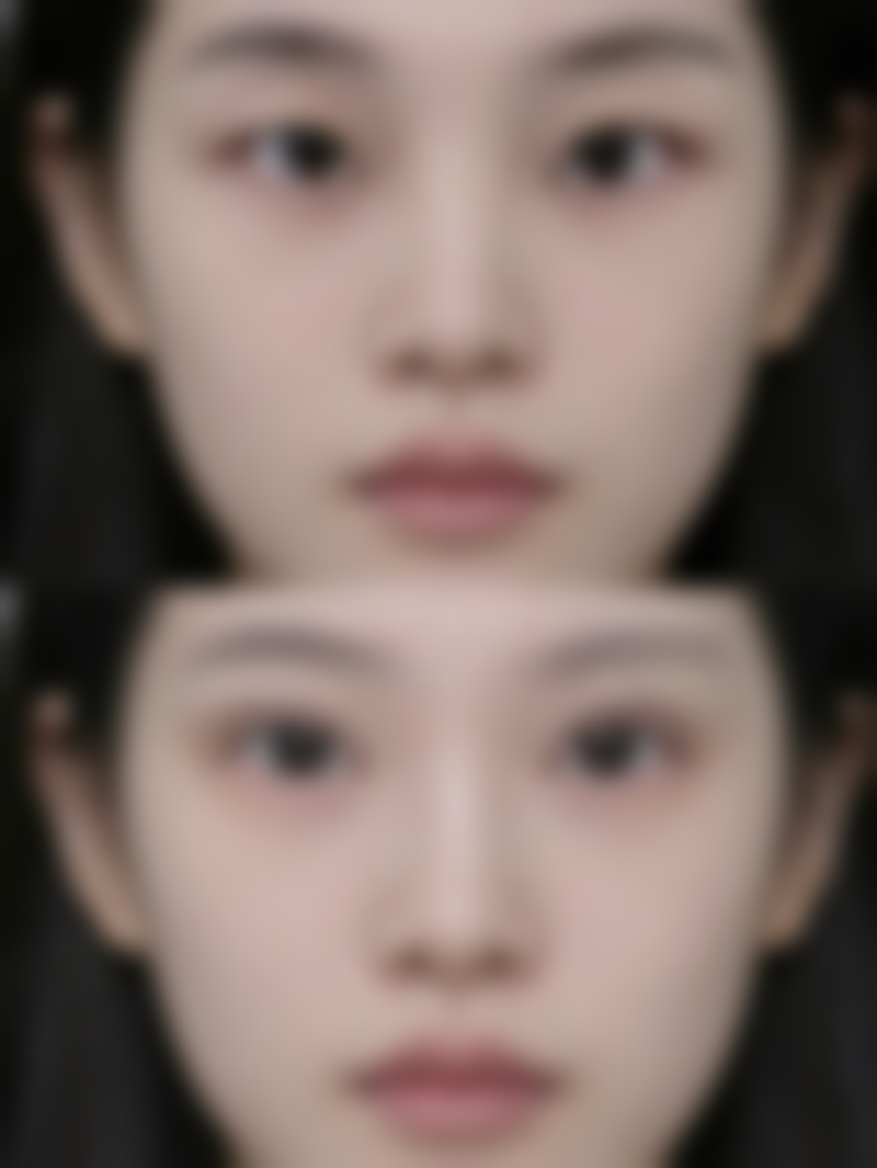 李志敏医生的医美技术特点