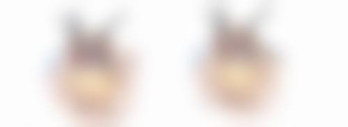 少女阴道紧缩术后如何护理