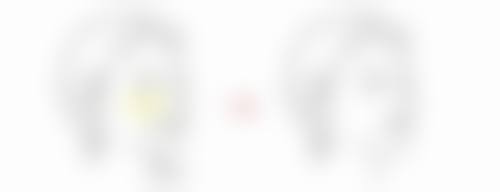 David 医生真实实例：眼见为实的美丽蜕变