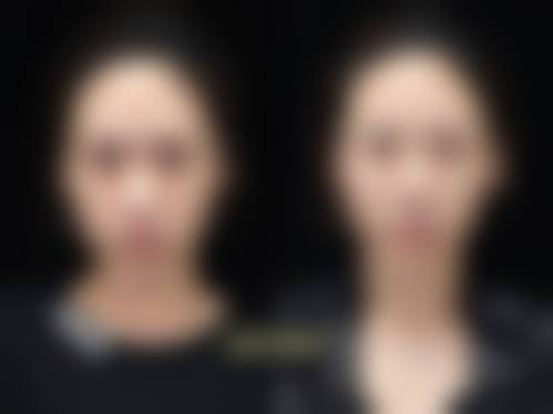 宁波鄞州首美整形医院医生名单：专精团队为你护航