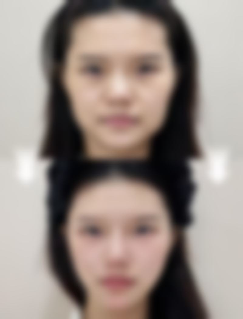 济宁曲阜医联美雅致医疗美容诊所真实实例