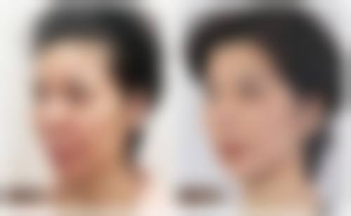 藤泽Medical诊所仪器设备：精良科技助力美丽