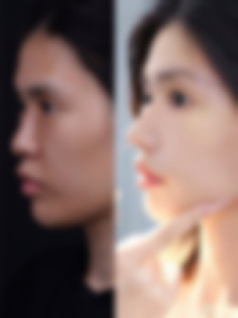 福建医 科 大学附属第一医院整形（美容）外科地址及乘车路线