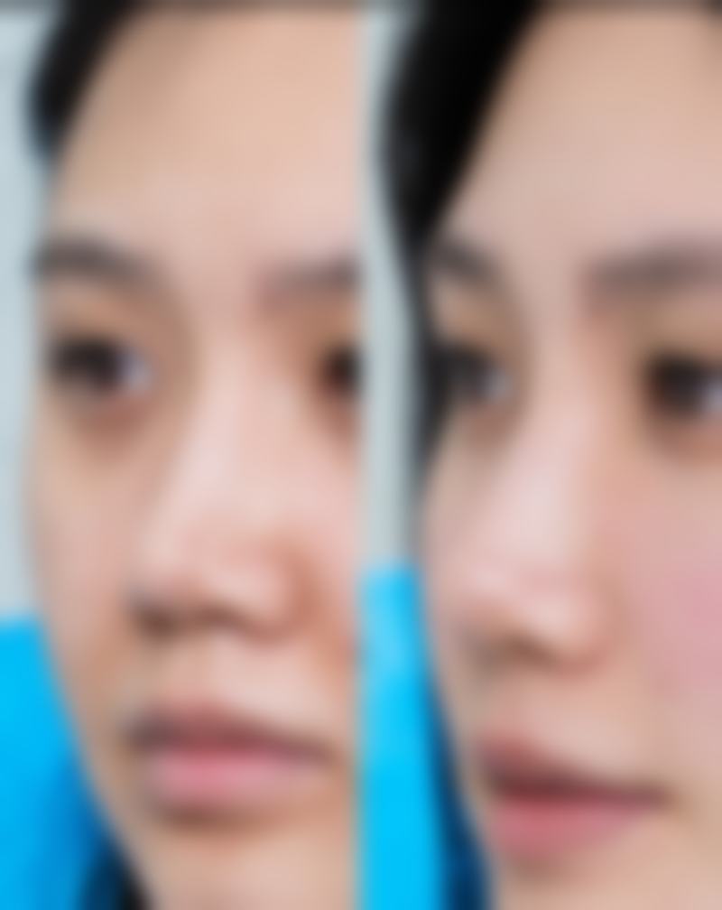 曹立铭医生技术特点：精细、创新、个性化