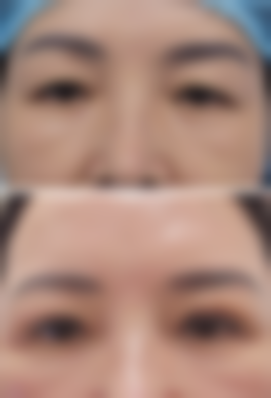 南宁华美医学整形美容医院擅长项目：打造专属美丽