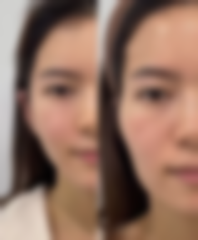 周芮医生的真实实例