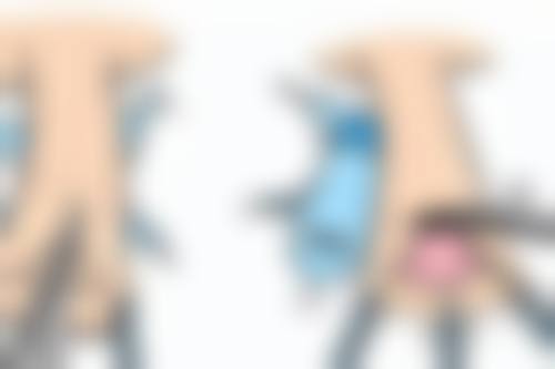 纳米无痕双眼皮和埋线双眼皮哪个更靠谱