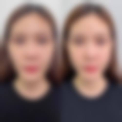 上海莱森整形医疗美容门诊部擅长项目：满足多样美丽需求