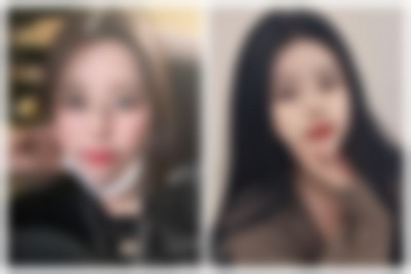 修复烫伤凹凸疤痕后会复发吗？