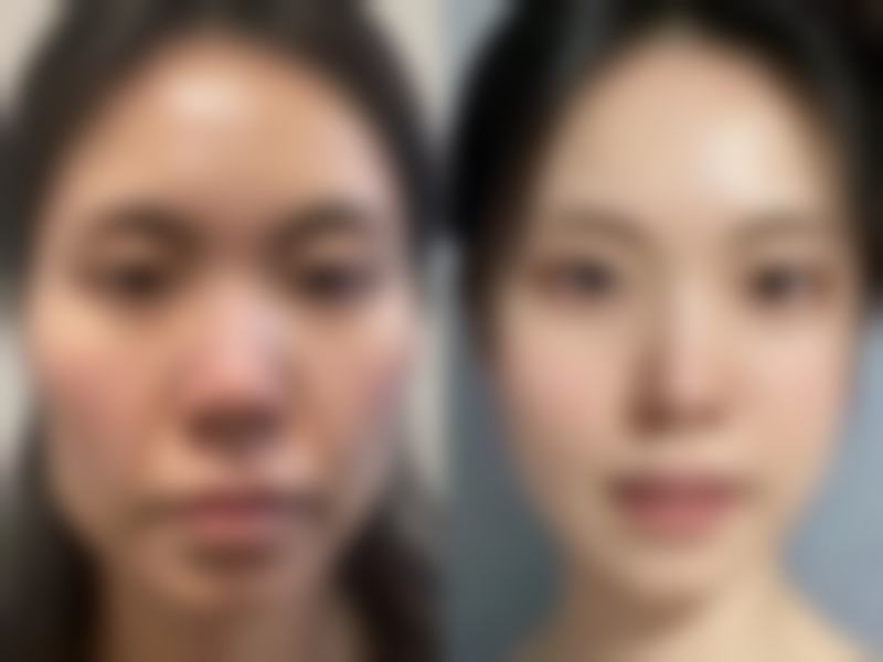 武汉斯启诺医疗美容门诊部叶锋手术风格靠谱吗？