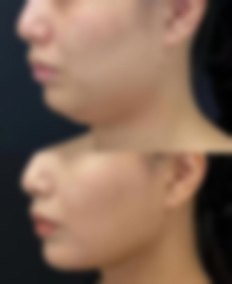 探索彭华伟医生的技术特点