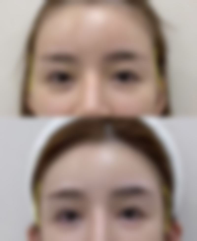 贵阳美贝尔陈斌院长修复疤痕值不值