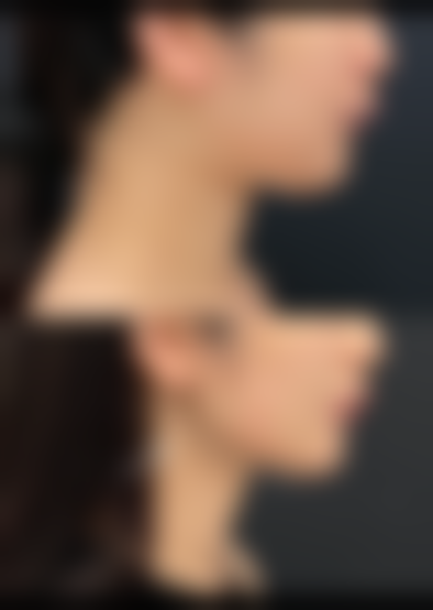 佛山颜植医疗美容门诊部预约挂号方式