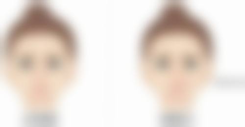 日本酒井形成外科医院真实实例：见证美丽蜕变