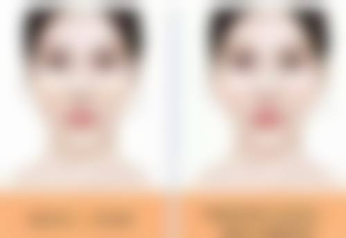 吴美容医生口碑评价