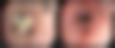 大连瓦房店妇婴医院整形美容科口碑怎么样