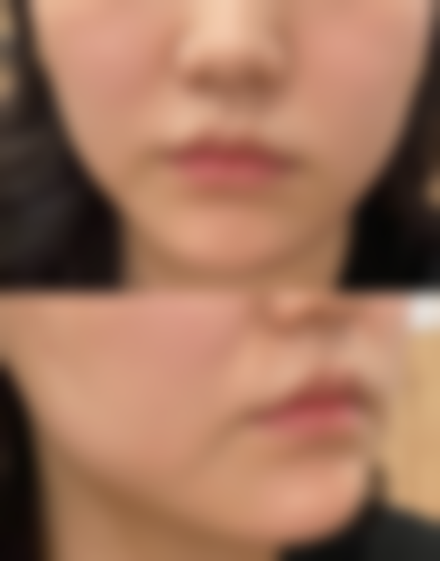 西安新城斑巢堂中医医院医疗美容科口碑怎么样