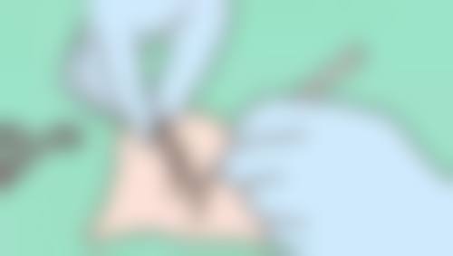 武汉斯启诺医疗美容门诊部王伟民能提供个性化医美方案吗