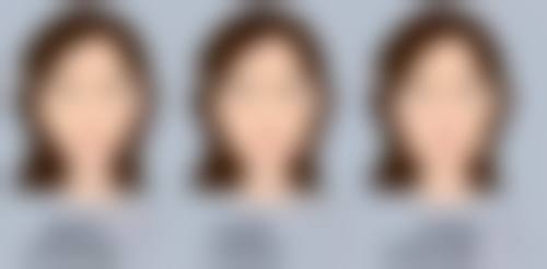 二次隆鼻能重塑鼻型靠谱吗