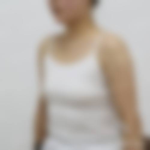 西安高岚医疗美容诊所医生名单：专精团队打造美丽