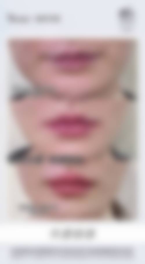 韩国JJ洪镇柱整形外科真实实例