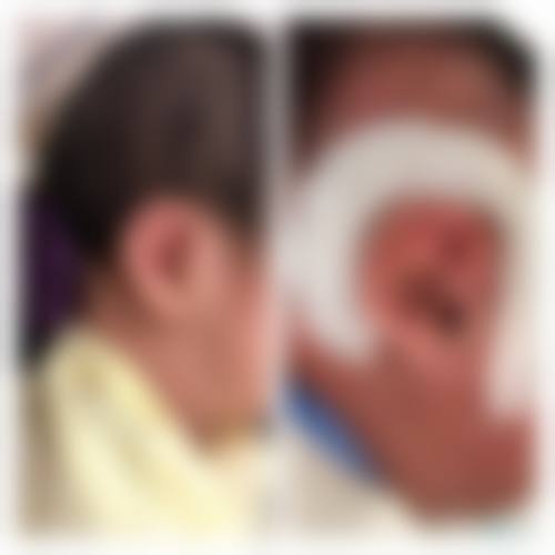 广州联成益美整形医院真实实例