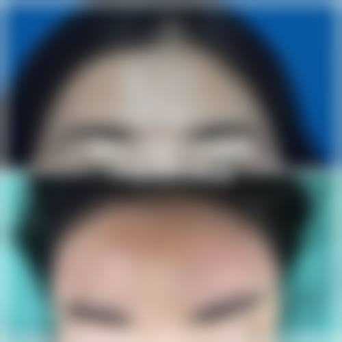 济南俏嘉丽医疗美容门诊部真实实例