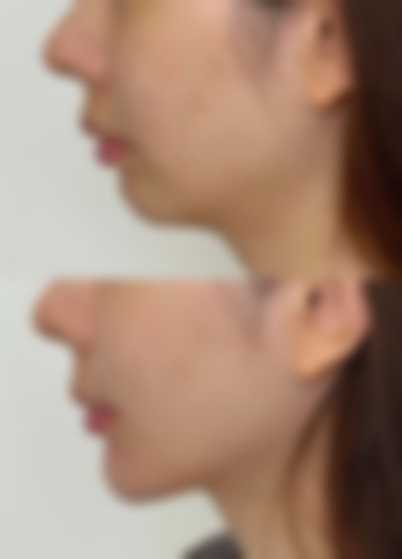 湖州南林美之匠整形医院营业时间