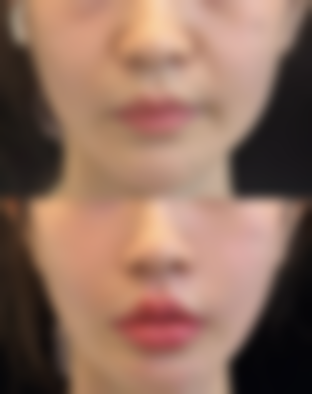 湖州南林美之匠整形医院电话号码