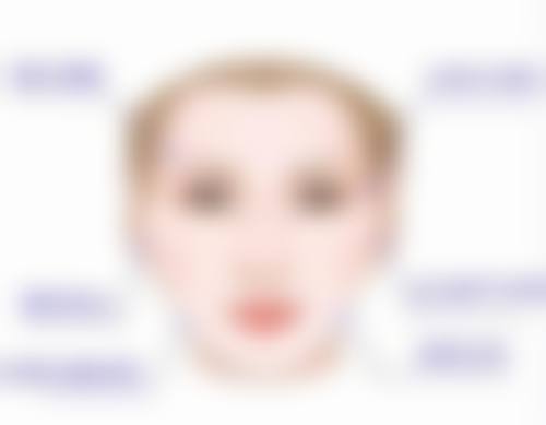 清除眼袋后如何护理