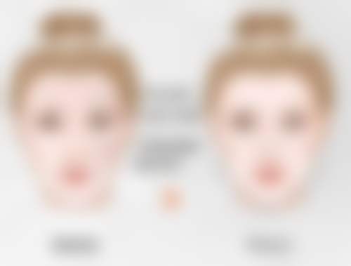 注射隆鼻肿胀感染风险大吗