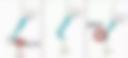 清除眼袋医美方法值不值