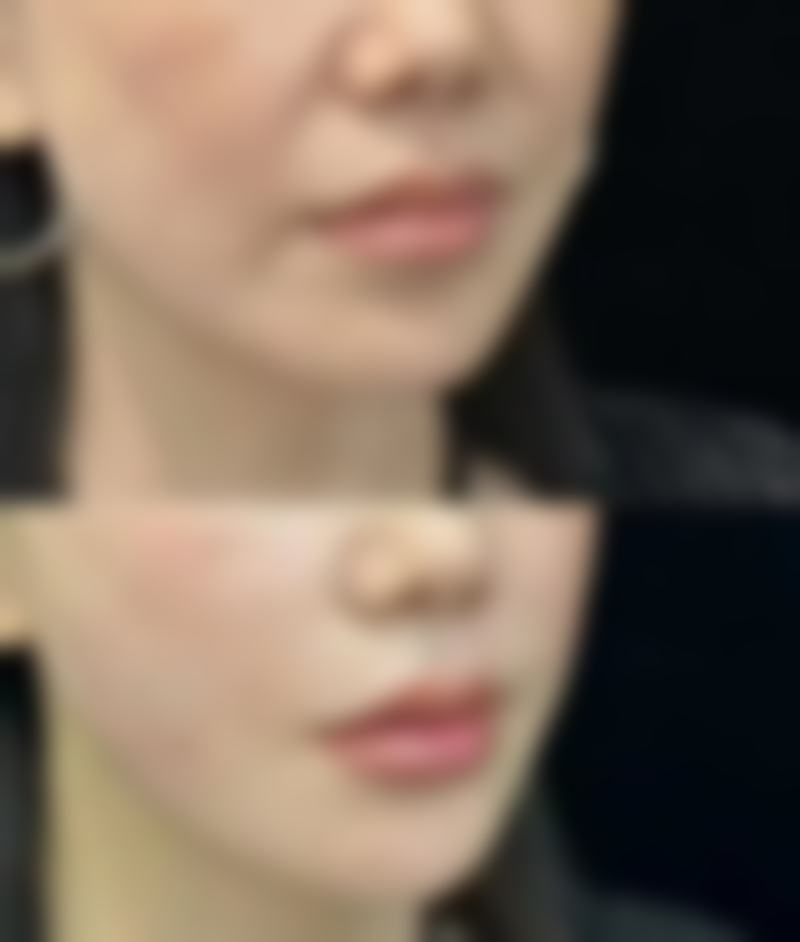 上杭语卿整形医院营业时间：贴心安排变得更美时间