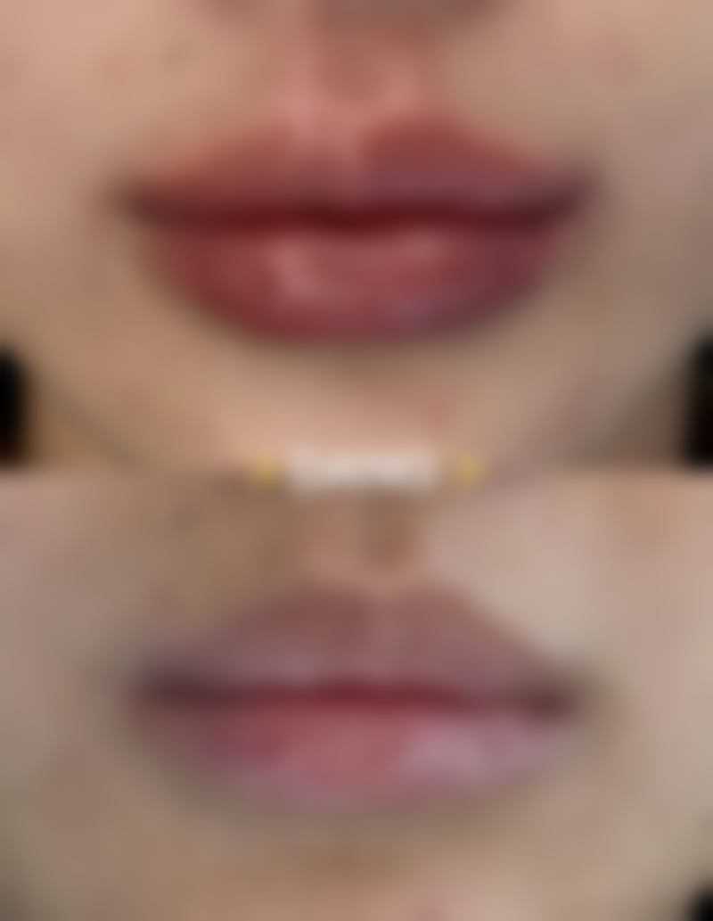 郑志敏医生技术特点