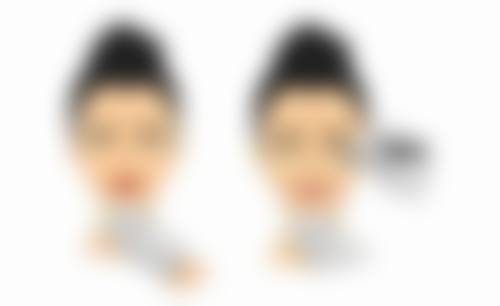 面部抽脂价格和成效成正比吗