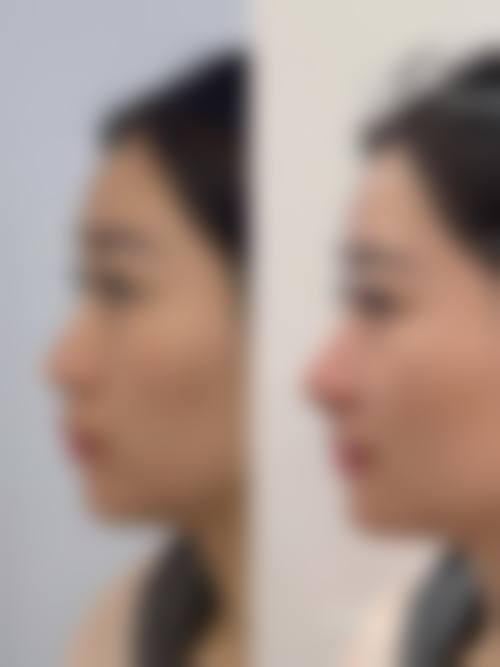 北京亚汇利中医美容有限职责公司亚韩医疗美容诊所真实实例