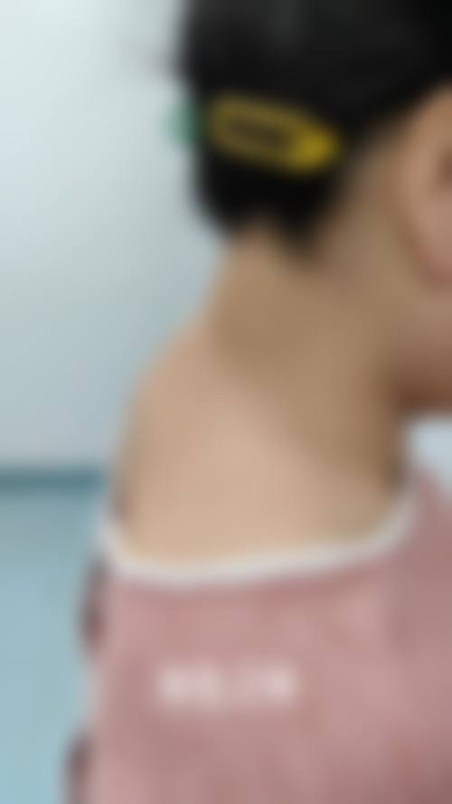 黄冈浠水海沁医疗美容门诊部真实实例