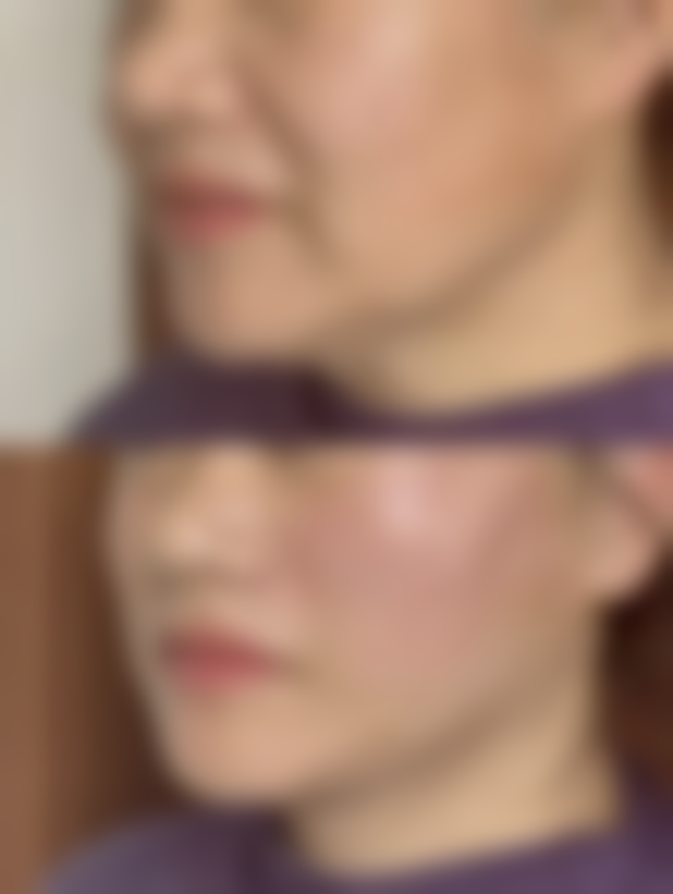 周芮医生的擅长项目