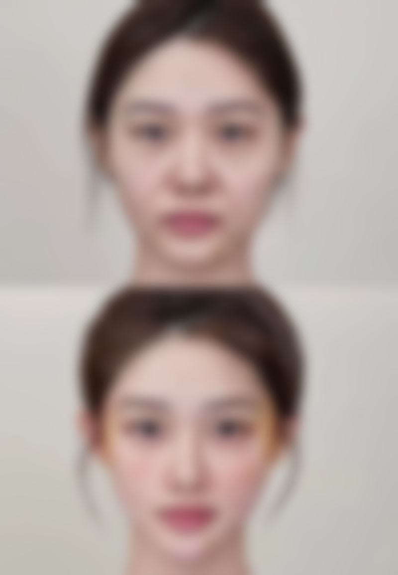 郑在渊医生看诊优势