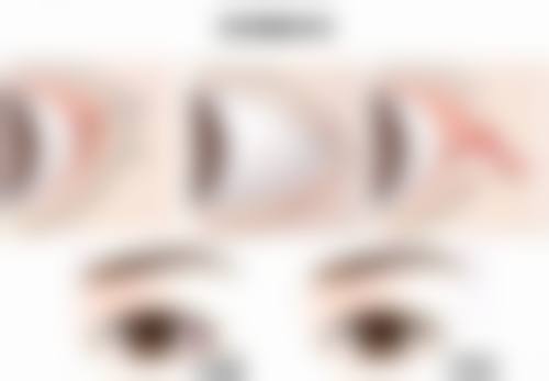 按压法判断自己是双眼皮准吗