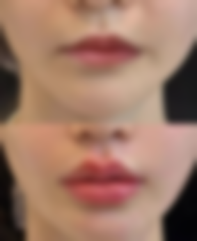 李唯禎院长擅长的项目