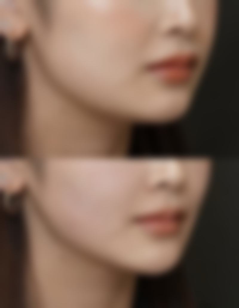 佐藤兼重院长的真实实例