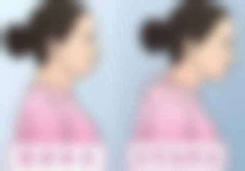 杭州丽兹医疗美容真实实例