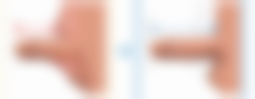 马芸医生的技术特点