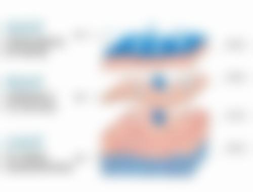 30岁做去眼袋手术值不值