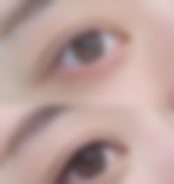 王学亚医生擅长项目